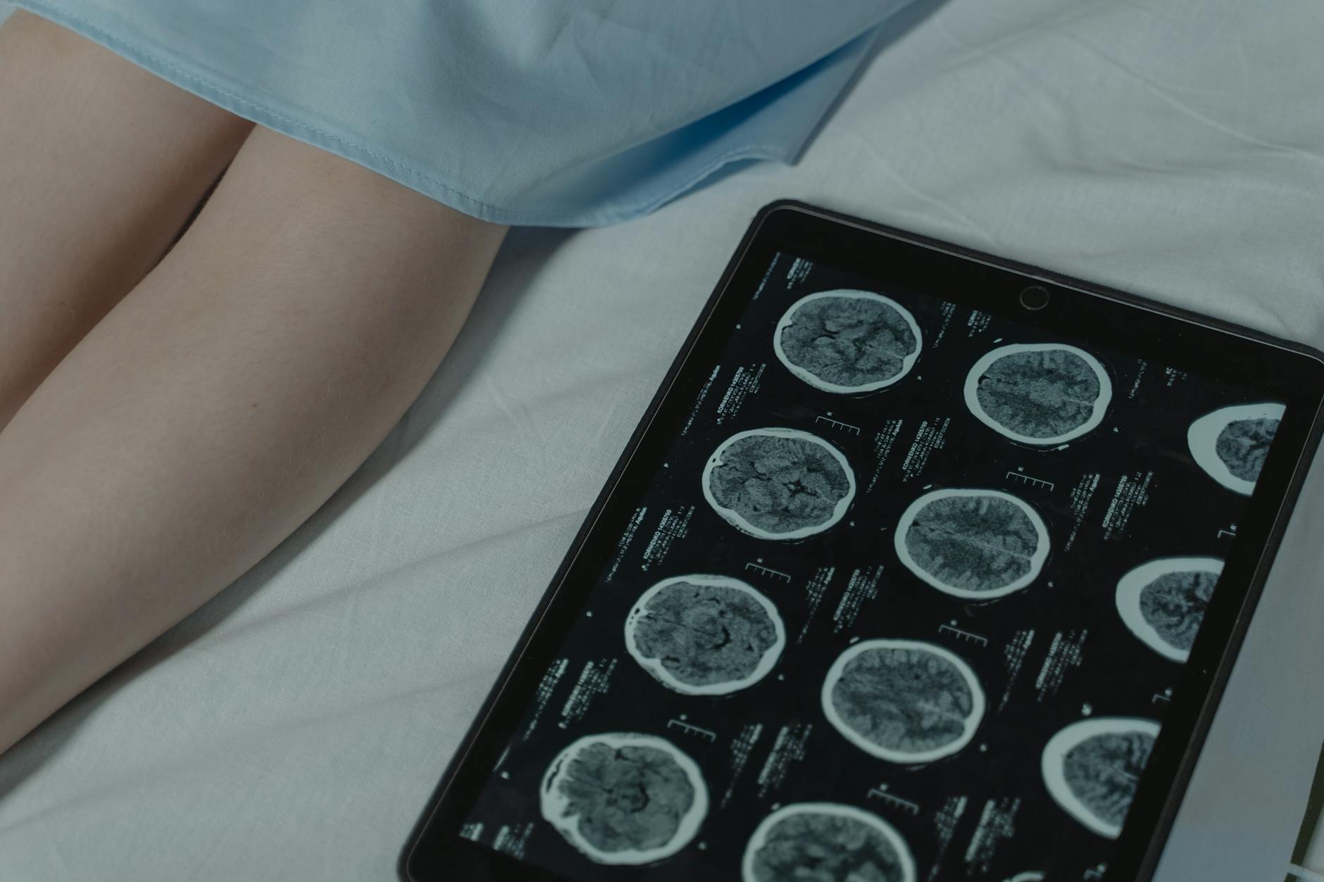 ct scan result on digital tablet